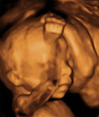 Ecografía semana 20: bebé tapándose la cara	