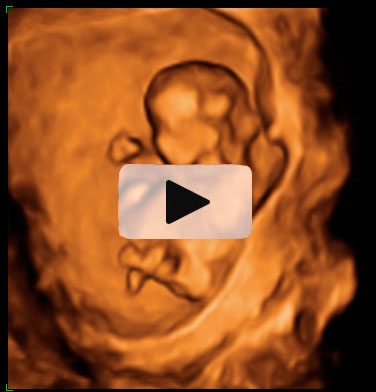 Ecografía en 4D de feto de 11 semanas moviéndose