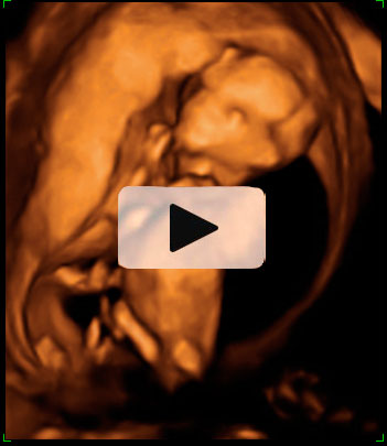 Ecografía en 4D de un feto de 12 semanas