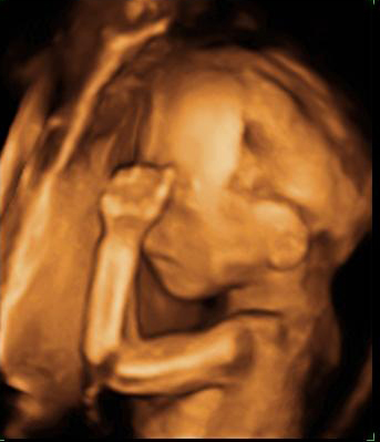 Ecografía semana 20: hueso de cráneo y brazo del bebé