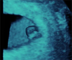 que sucede semana 5 embarazo