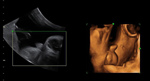 tercer trimestre sexo masculino