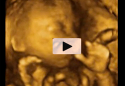 Ecografía feto de 19 semanas y 4 días