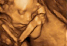 Ecografía 3D de la semana 20: Feto de perfil