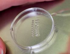 Defectos del tubo neural